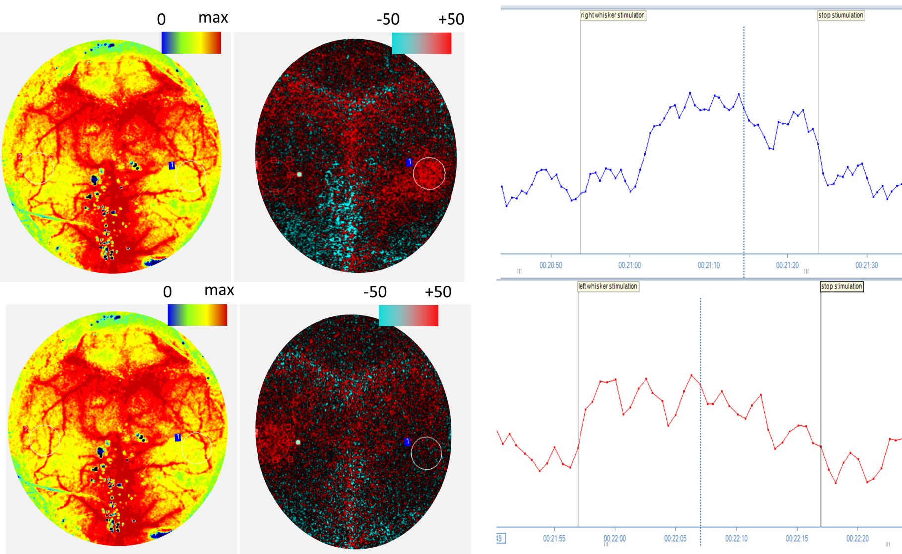 Images de la perfusion d’un cerveau de souris - Monitoring flux sanguin cérébral